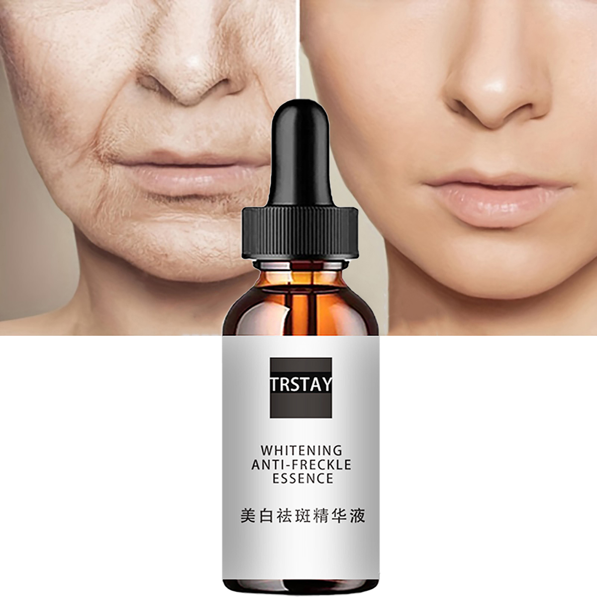 Niacinamide Acid Facial Essenc - Niacinamide Pore Shrinking Essence recension och pris